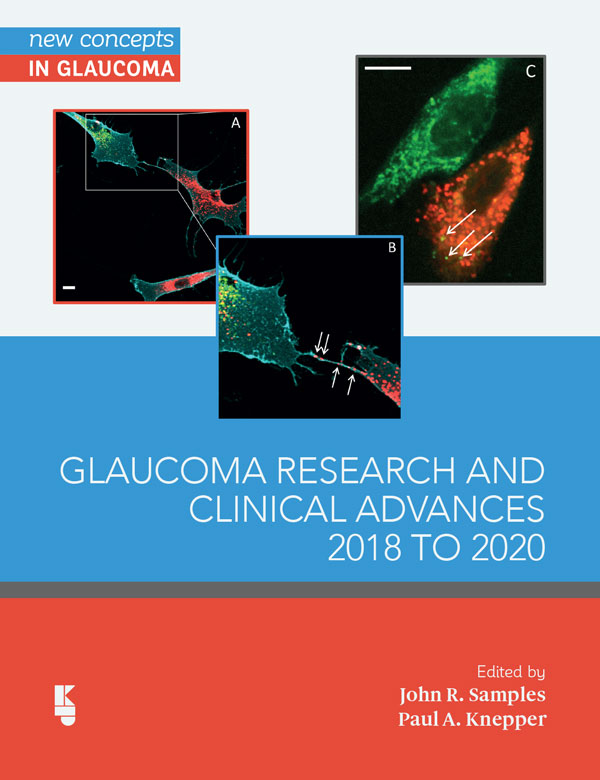 new glaucoma research